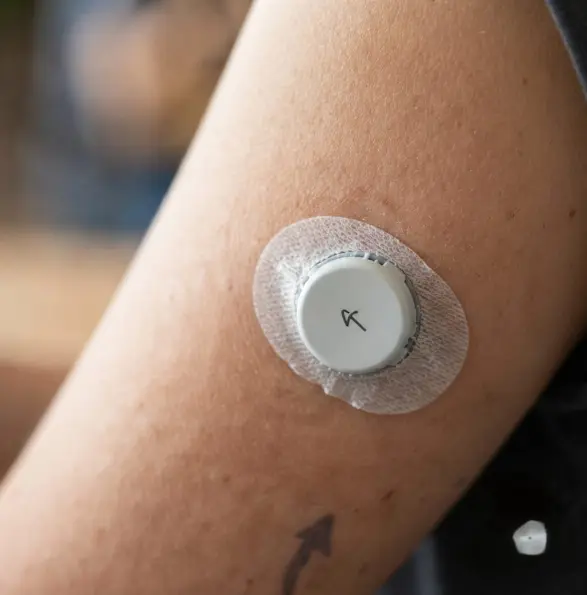 Sensore CGM per il monitoraggio